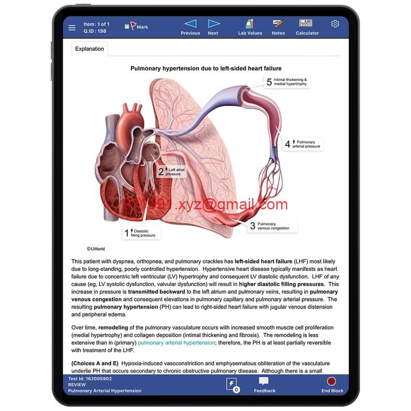 图片[4]-UWorld USMLE Step 1+2 Qbank 2022 QnA MBBS MD MCAT BMAT-趋势跟踪之道Pro